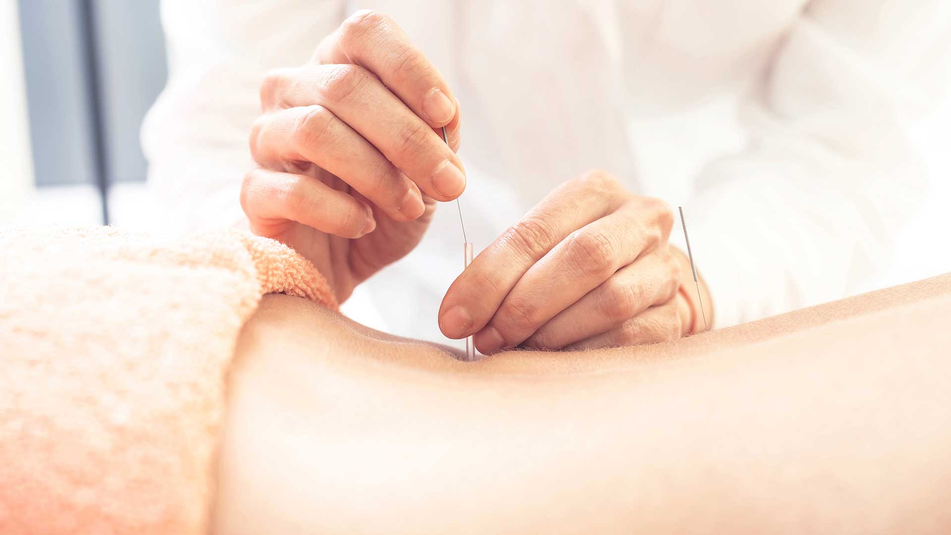Acupuncture treatment
