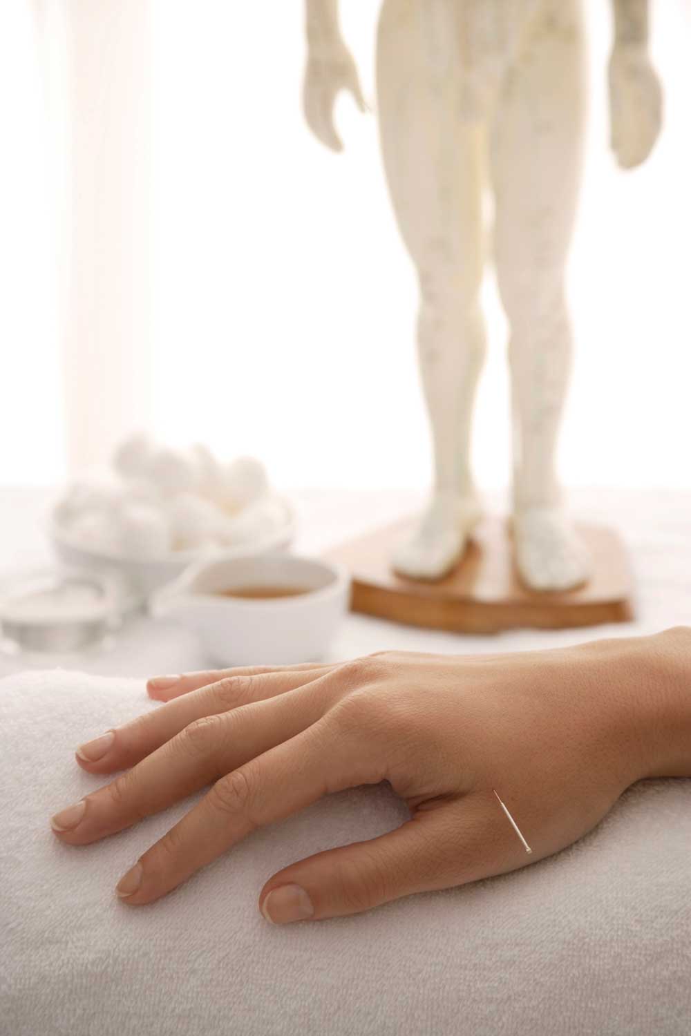Acupuncture System