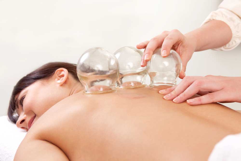 Chinese Medicine Cupping